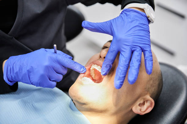 Best Chipped Tooth Repair Near Me  in Sheridan, CA