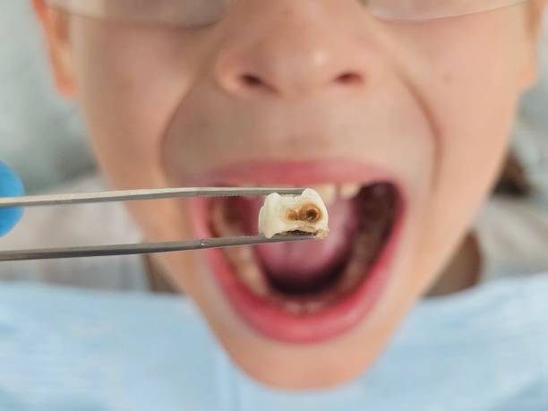 Best Tooth Pain Emergency Relief  in Sheridan, CA